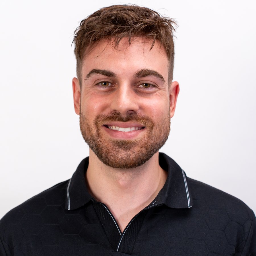 Real Gen'C client after — natural-looking hair system