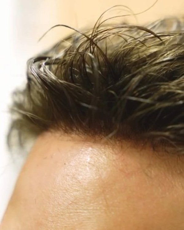 Hairline close-up — natural, seamless hairline at Gen'C